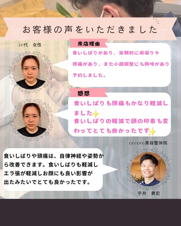 エラ張りでお悩みのお客様の声