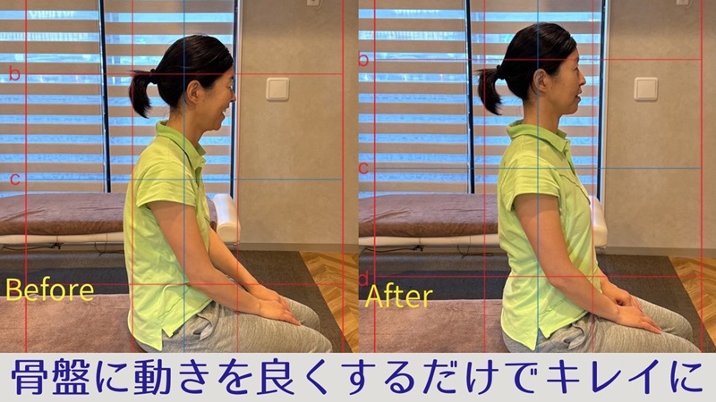 骨盤調整でお悩みのビフォーアフター画像