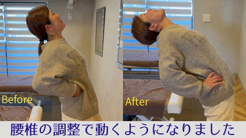 腰痛でお悩みのビフォーアフター画像