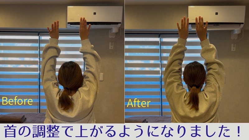 肩こりでお悩みのビフォーアフター画像